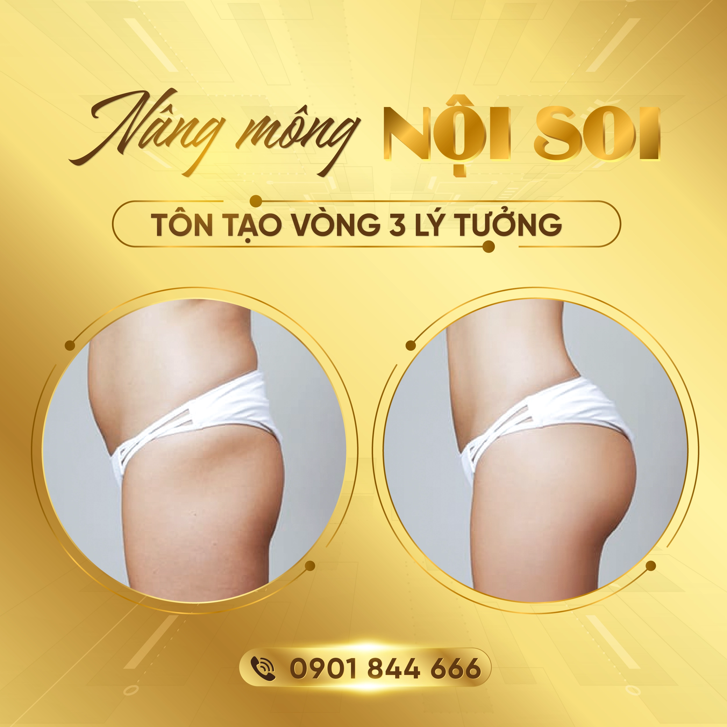 Phẫu thuật TM-01